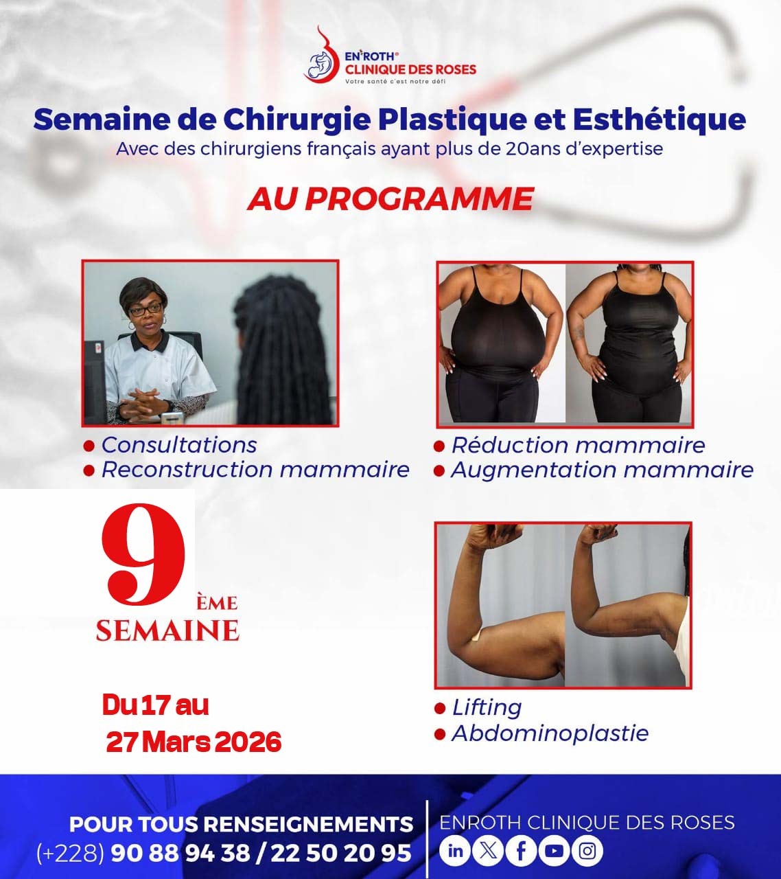 Projet Chrirurgie 2026 2